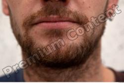 Mouth White Average Bearded